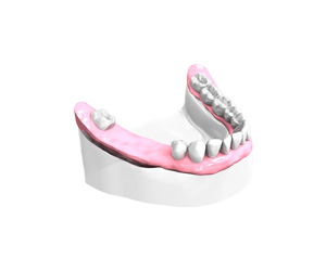 Examen-pre-implantaire-Dentiste – Dentiste Boulogne Billancourt